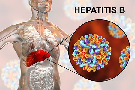 Graphic of a skeleton with hepatitis B